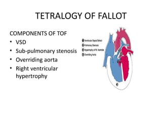 Comprehensive Overview of Congenital Cyanotic Heart Diseases and ...