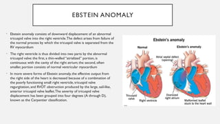 congenital cyanotic heart disorders.pptx