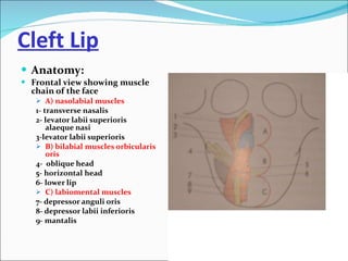 Congenital defects of the Face | PPT