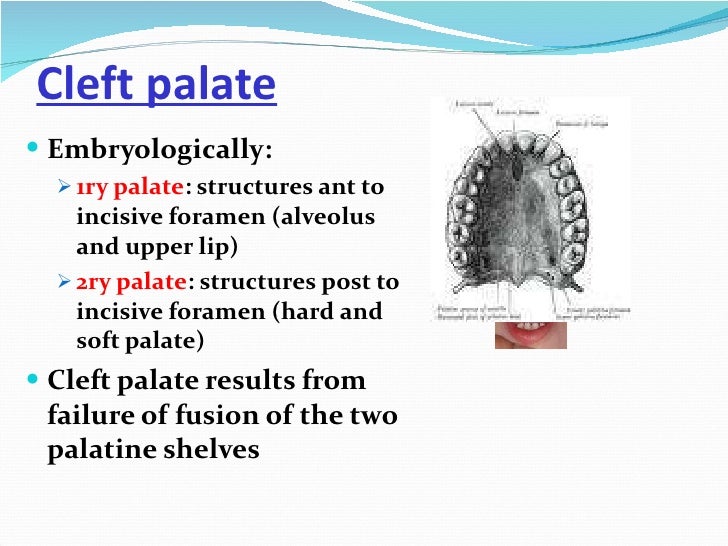 Congenital defects of the Face