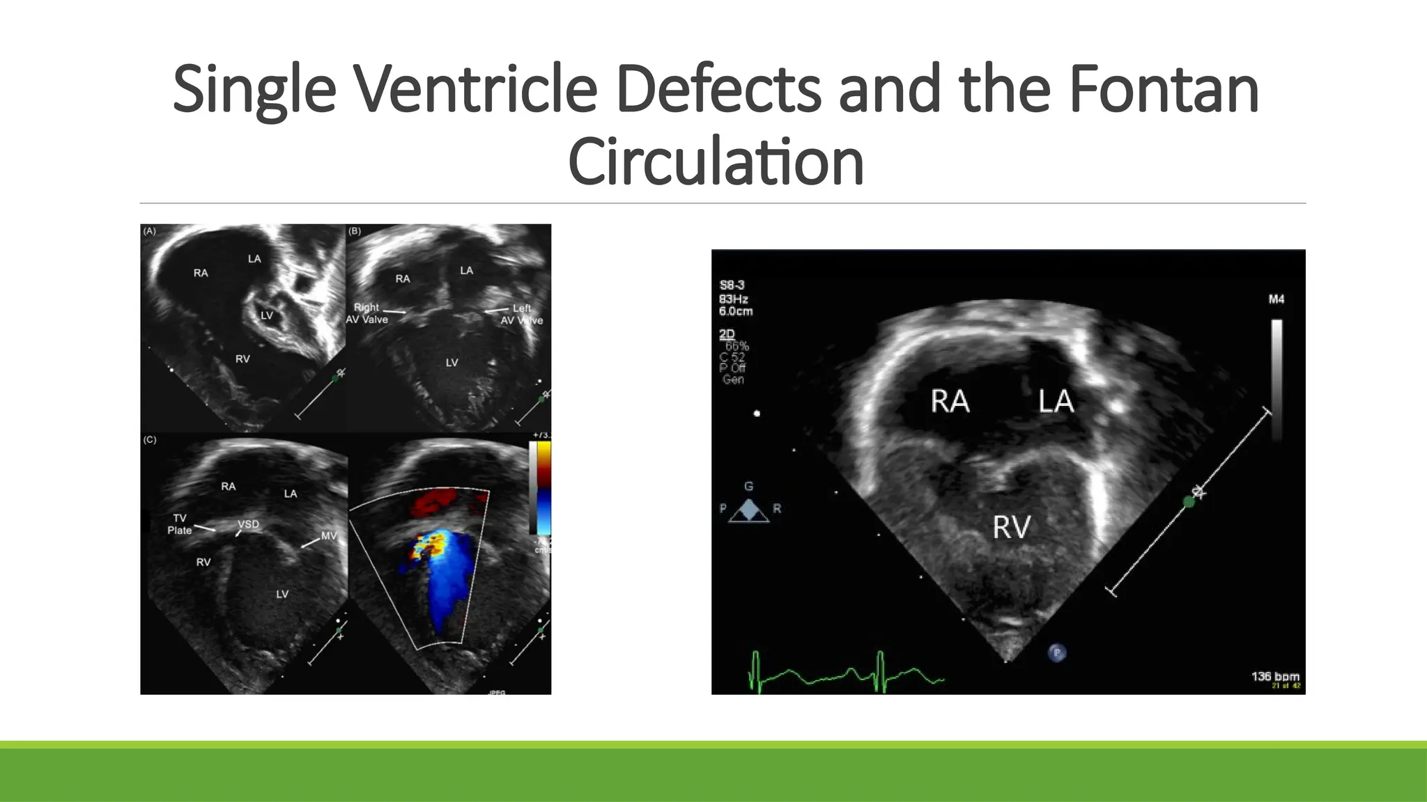 congenital defects of the heart in adults.pptx