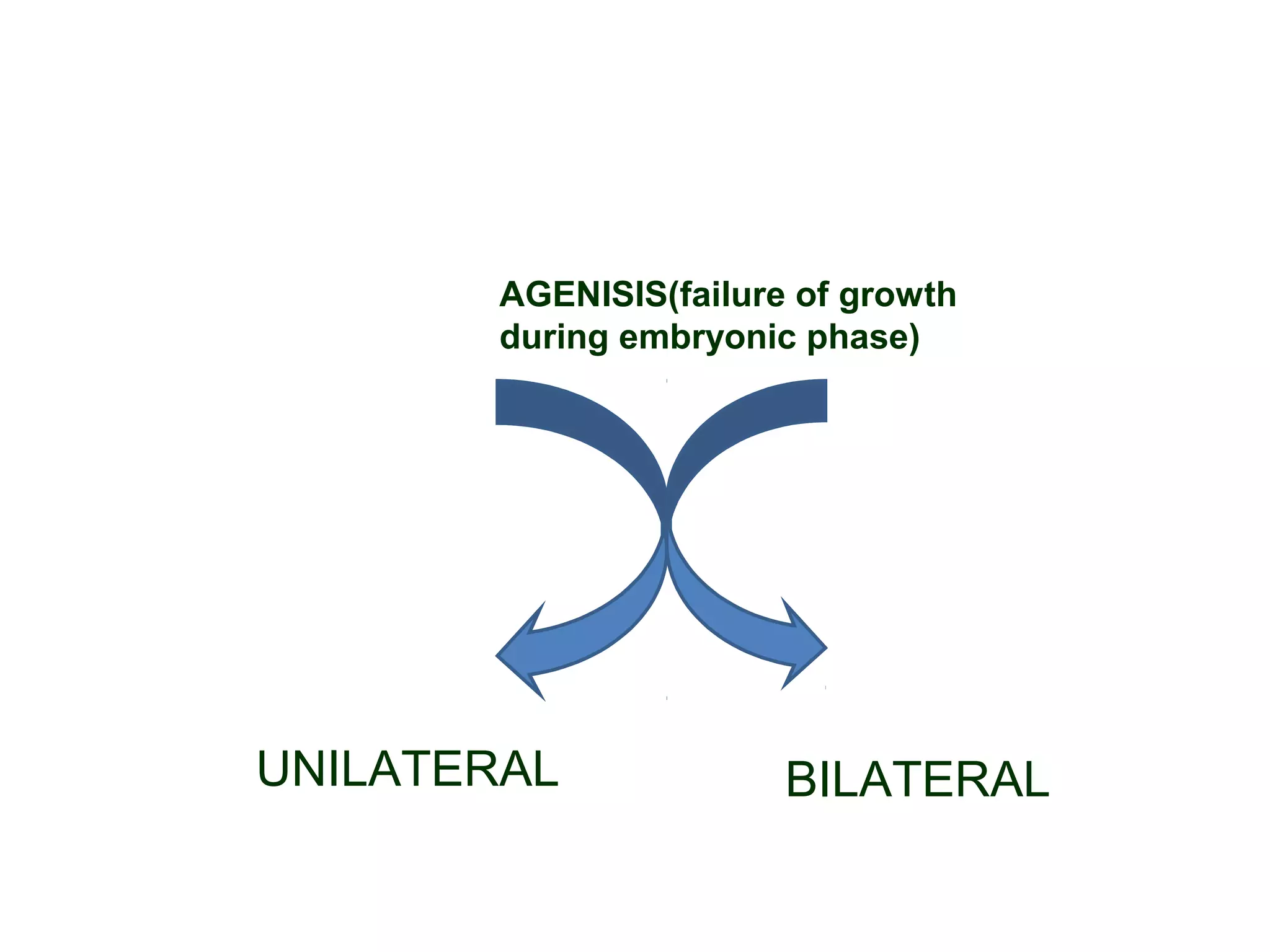 AGENISIS(failure of growth
during embryonic phase)
UNILATERAL BILATERAL
 