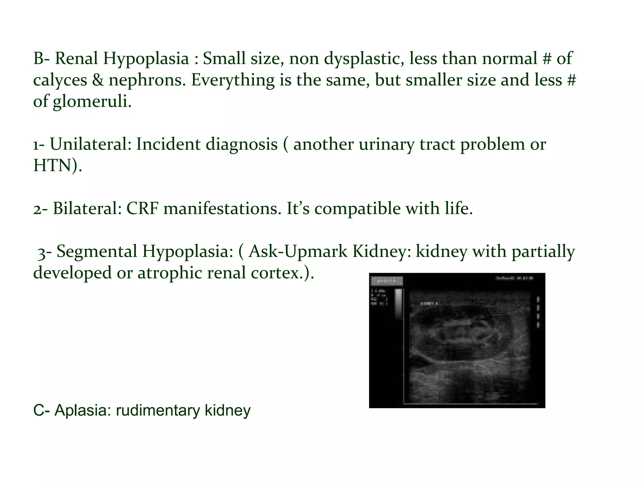 B- Renal Hypoplasia : Small size, non dysplastic, less than normal # of
calyces & nephrons. Everything is the same, but smaller size and less #
of glomeruli.
1- Unilateral: Incident diagnosis ( another urinary tract problem or
HTN).
2- Bilateral: CRF manifestations. It’s compatible with life.
3- Segmental Hypoplasia: ( Ask-Upmark Kidney: kidney with partially
developed or atrophic renal cortex.).
C- Aplasia: rudimentary kidney
 