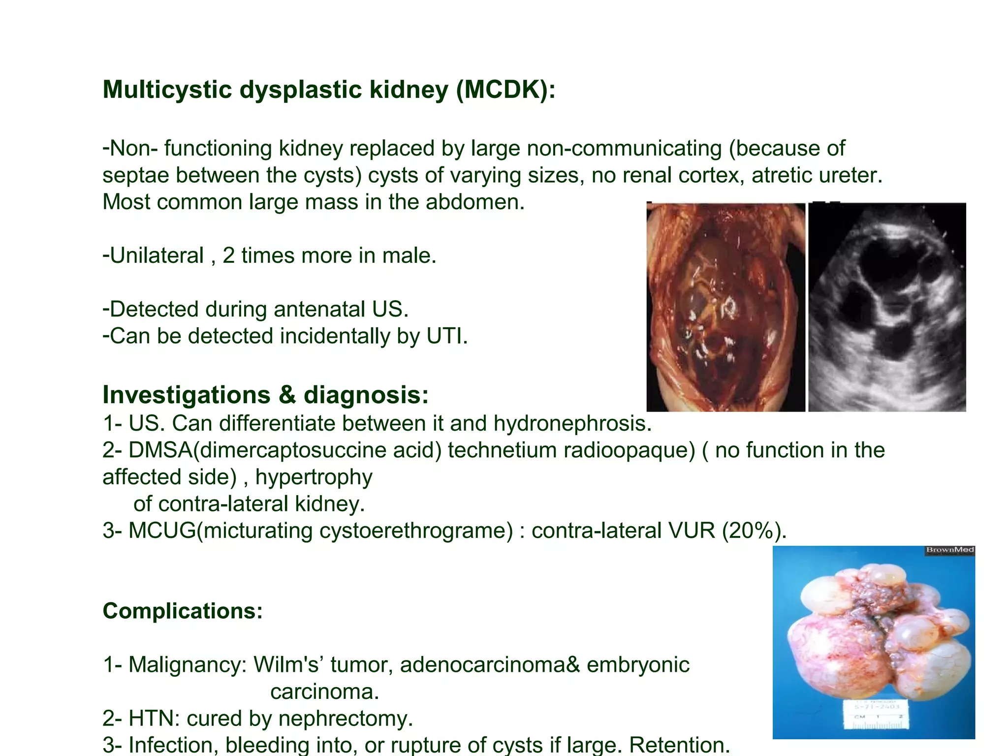 Multicystic dysplastic kidney (MCDK):
-Non- functioning kidney replaced by large non-communicating (because of
septae between the cysts) cysts of varying sizes, no renal cortex, atretic ureter.
Most common large mass in the abdomen.
-Unilateral , 2 times more in male.
-Detected during antenatal US.
-Can be detected incidentally by UTI.
Investigations & diagnosis:
1- US. Can differentiate between it and hydronephrosis.
2- DMSA(dimercaptosuccine acid) technetium radioopaque) ( no function in the
affected side) , hypertrophy
of contra-lateral kidney.
3- MCUG(micturating cystoerethrograme) : contra-lateral VUR (20%).
Complications:
1- Malignancy: Wilm's’ tumor, adenocarcinoma& embryonic
carcinoma.
2- HTN: cured by nephrectomy.
3- Infection, bleeding into, or rupture of cysts if large. Retention.
 