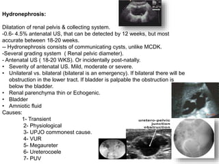 Hydronephrosis:
Dilatation of renal pelvis & collecting system.
-0.6- 4.5% antenatal US, that can be detected by 12 weeks, but most
accurate between 18-20 weeks.
-- Hydronephrosis consists of communicating cysts, unlike MCDK.
-Several grading system ( Renal pelvic diameter).
- Antenatal US ( 18-20 WKS). Or incidentally post-natally.
• Severity of antenatal US. Mild, moderate or severe.
• Unilateral vs. bilateral (bilateral is an emergency). If bilateral there will be
obstruction in the lower tract. If bladder is palpable the obstruction is
below the bladder.
• Renal parenchyma thin or Echogenic.
• Bladder
• Amniotic fluid
Causes:
1- Transient
2- Physiological
3- UPJO commonest cause.
4- VUR
5- Megaureter
6- Ureterocoele
7- PUV
 