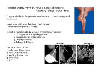 Posterior urethral valve (PUV):Commonest obstructive
Uropathy in boys , 1:5000- 8000
Congenital valve in the posterior urethra due to persistent urogenital
membrane.
-Associated with renal dysplasia ( Back pressure,
common developmental insult).
Risk of perinatal mortality & risk of chronic kidney disease:
1- US suggestive at < 24 wks gestation.
2- Severe bilateral hydronephrosis.
3- Oligohydramnios.
4- Echogenic kidneys.
Postnatal presentations:
1- pulmonary Hypoplasia.
2- Poor urinary stream
3- Voiding dysfunction.
4- Urosepsis.
5- FTT.
 