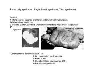 Prune belly syndrome ( Eagle-Barrett syndrome, Triad syndrome)
Triad of:
1- Deficiency or absence of anterior abdominal wall musculature.
2- Bilateral cryptorchidism
3- bilateral Ureter ,bladder,& urethral abnormalities( megacystis, Megaureter
2°
dysplasia.
-Other systemic abnormalities in 75%:
1- GI : malrotation, gastroschisis.
2- Heart: CHD
3- Skeletal: talipes equinovarus, CDH.
4- Pulmonary hypoplasia
 