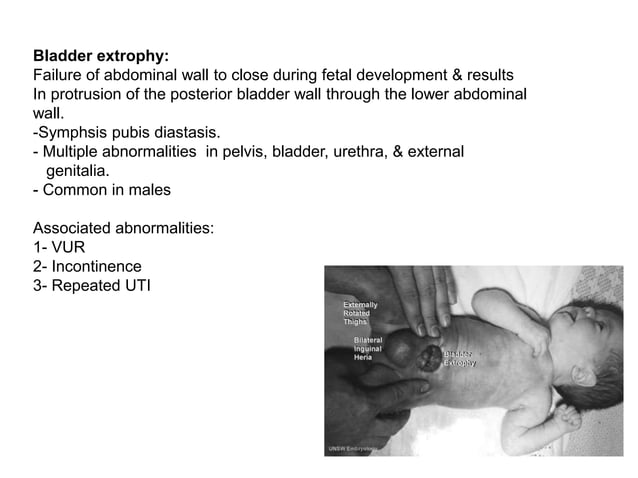 Congenital Development of Urinary System.pptx | Pregnancy ...