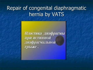 Repair of congenital diaphragmatic hernia  by VATS 