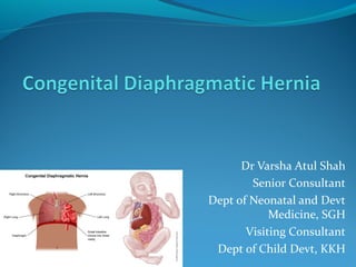 Dr Varsha Atul Shah
Senior Consultant
Dept of Neonatal and Devt
Medicine, SGH
Visiting Consultant
Dept of Child Devt, KKH
 