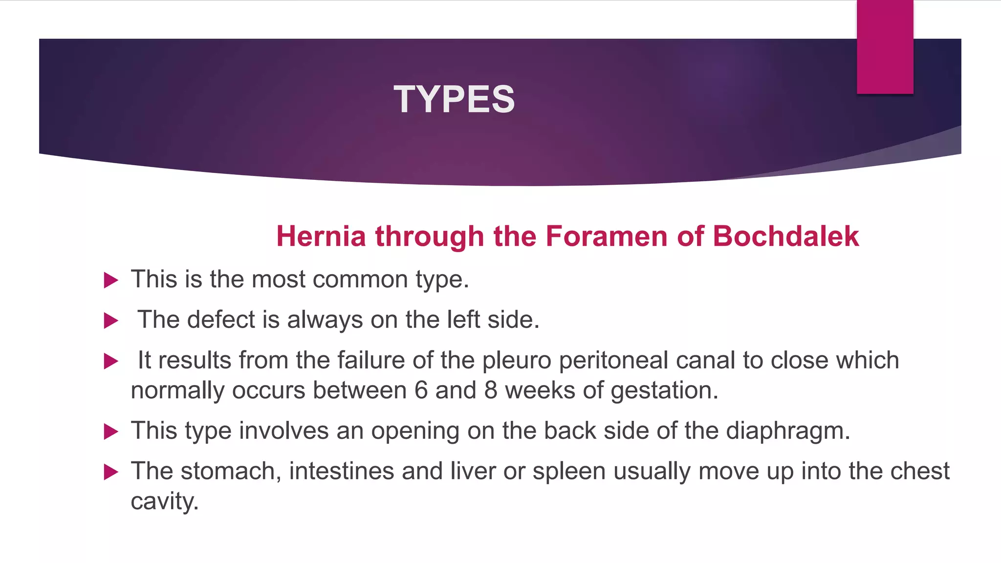 Congenital Diaphragmatic Hernia | PPTX