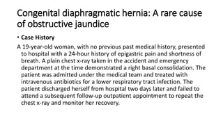 Congenital diaphragmatic hernia | PPT