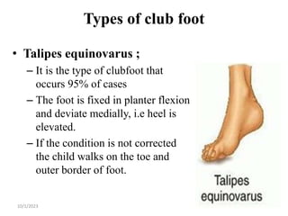 Congenital disorders.ppt