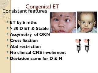 Congenital Esotropia diagnosis and management.pptx