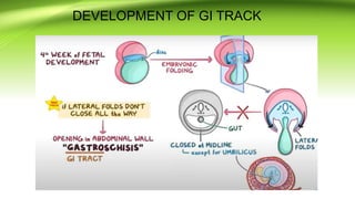 Gi Incurred Development Pattern congenitalgastrointestinalanomalies-161121183124.pptx
