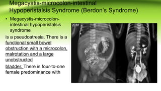 congenitalgastrointestinalanomalies-161121183124.pptx
