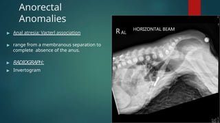 congenitalgastrointestinalanomalies-161121183124.pptx