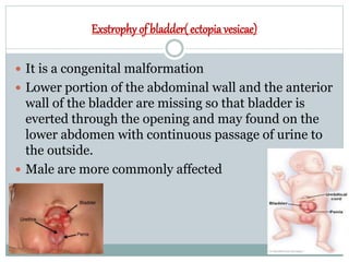 Exstrophy of bladder( ectopia vesicae)
 It is a congenital malformation
 Lower portion of the abdominal wall and the anterior
wall of the bladder are missing so that bladder is
everted through the opening and may found on the
lower abdomen with continuous passage of urine to
the outside.
 Male are more commonly affected
 