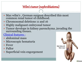 Wilm’s tumor (nephroblastoma)
 Max wilm’s , German surgeon described this most
common renal tumor of childhood.
 Chromosomal deletions 11 and 16
 Highly malignant embryonal tumor
 Tumor develops in kidney parenchyma ,invading the
surrounding tissues.
Clinical features :
 abdominal mass
 Microscopic hematuria
 Fever
 Pallor
 Superficial vein engorgement
 