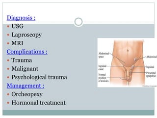 Diagnosis :
 USG
 Laproscopy
 MRI
Complications :
 Trauma
 Malignant
 Psychological trauma
Management :
 Orcheopexy
 Hormonal treatment
 