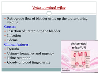 Vesico – urethral reflux
 Retrograde flow of bladder urine up the ureter during
voiding.
Causes:
 Insertion of ureter in to the bladder
 Infection
 Edema
Clinical features:
 Dysuria
 Urinary frequency and urgency
 Urine retention
 Cloudy or blood tinged urine
 
