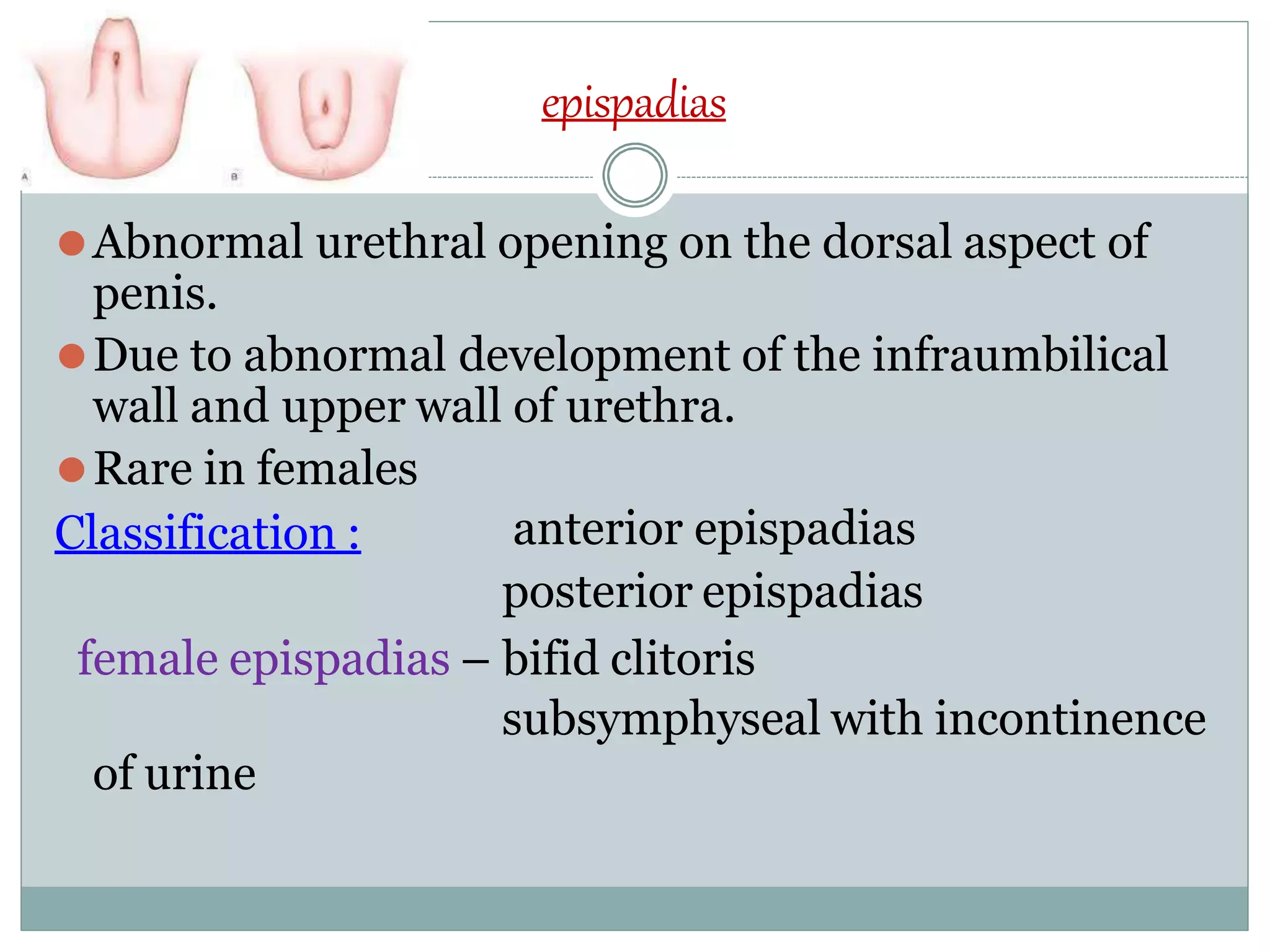 CONGENITAL GENITO URINARY DISORDERS.pptx