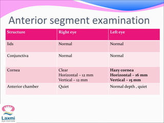 Structure Right eye Left eye
lids Normal Normal
Conjunctiva Normal Normal
Cornea Clear
Horizontal – 12 mm
Vertical – 12 mm
Hazy cornea
Horizontal – 16 mm
Vertical – 15 mm
Anterior chamber Quiet Normal depth , quiet
Anterior segment examination
 