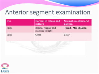 Anterior segment examination
Iris Normal in colour and
pattern
Normal in colour and
pattern
Pupil Round, regular and
reacting to light
Fixed , Mid-dilated
Lens Clear Clear
 