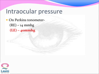 Intraocular pressure
 On Perkins tonometer-
(RE) – 14 mmhg
(LE) – 40mmhg
 