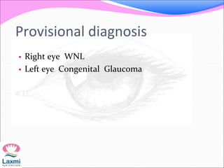 Provisional diagnosis
 Right eye WNL
 Left eye Congenital Glaucoma
 