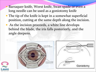  Barraquer knife, Worst knife, Swan spade or even a
long needle can be used as a goniotomy knife
 The tip of the knife is kept in a somewhat superficial
position, cutting at the same depth along the incision.
 As the incision proceeds, a white line develops
behind the blade, the iris falls posteriorly, and the
angle deepens.
 
