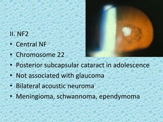 II. NF2
• Central NF
• Chromosome 22
• Posterior subcapsular cataract in adolescence
• Not associated with glaucoma
• Bilateral acoustic neuroma
• Meningioma, schwannoma, ependymoma
 