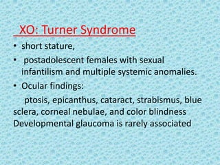 XO: Turner Syndrome
• short stature,
• postadolescent females with sexual
infantilism and multiple systemic anomalies.
• Ocular findings:
ptosis, epicanthus, cataract, strabismus, blue
sclera, corneal nebulae, and color blindness
Developmental glaucoma is rarely associated
 