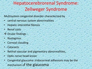 Hepatocerebrorenal Syndrome:
Zellweger Syndrome
Multisystem congenital disorder characterized by
• central nervous system abnormalities
• Hepatic interstitial fibrosis
• Renal cysts
 Ocular findings :
• Nystagmus
• Corneal clouding
• Cataracts
• Retinal vascular and pigmentary abnormalities,
• Optic nerve head lesion
• Congenital glaucoma :iridocorneal adhesions may be the
mechanism of the glaucoma
 