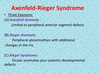 Axenfeld-Rieger Syndrome
• Three Eponyms:
(A) Axenfeld Anomaly :
Limited to peripheral anterior segment defects
(B) Rieger Anomaly:
Peripheral abnormalities with additional
changes in the iris
(C) Rieger Syndrome:
Ocular anomalies plus systemic developmental
defects
 