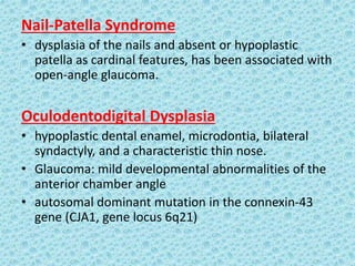 Nail-Patella Syndrome
• dysplasia of the nails and absent or hypoplastic
patella as cardinal features, has been associated with
open-angle glaucoma.
Oculodentodigital Dysplasia
• hypoplastic dental enamel, microdontia, bilateral
syndactyly, and a characteristic thin nose.
• Glaucoma: mild developmental abnormalities of the
anterior chamber angle
• autosomal dominant mutation in the connexin-43
gene (CJA1, gene locus 6q21)
 