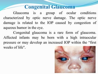 Congenital Glaucoma
Glaucoma is a group of ocular conditions
characterized by optic nerve damage. The optic nerve
damage is related to the IOP caused by congestion of
aqueous humor in the eye.
Congenital glaucoma is a rare form of glaucoma.
Affected infants may be born with a high intraocular
pressure or may develop an increased IOP within the “first
weeks of life".
 