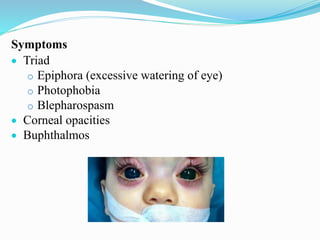 Symptoms
 Triad
o Epiphora (excessive watering of eye)
o Photophobia
o Blepharospasm
 Corneal opacities
 Buphthalmos
 