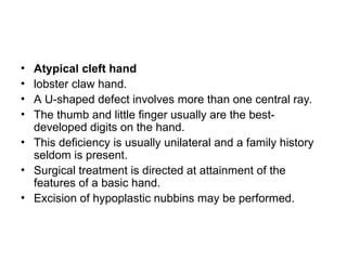 Comprehensive Classification and Treatment of Congenital Limb ...
