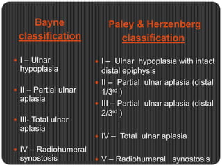 Paley Pfd Classification Congenital hand anomalies | PPTX