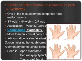 Congenital hand anomalies | PPTX