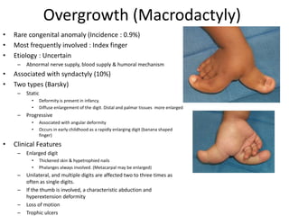 Congenital hand anomalies | PPTX