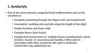 CONGENITAL HAND ANOMALIES PRESENTATION[1].pptxUPDATED 1.pptx