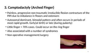 CONGENITAL HAND ANOMALIES PRESENTATION[1].pptxUPDATED 1.pptx