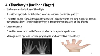 CONGENITAL HAND ANOMALIES PRESENTATION[1].pptxUPDATED 1.pptx
