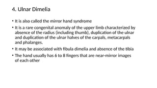 CONGENITAL HAND ANOMALIES PRESENTATION[1].pptxUPDATED 1.pptx