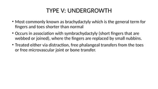 CONGENITAL HAND ANOMALIES PRESENTATION[1].pptxUPDATED 1.pptx