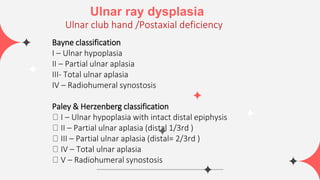Paley Pfd Classification congenital hand anomalies sa3d.pptx