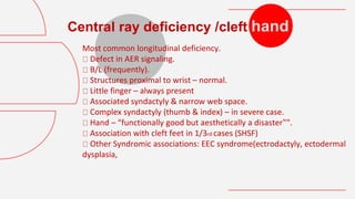 Hand Defect congenital hand anomalies sa3d.pptx