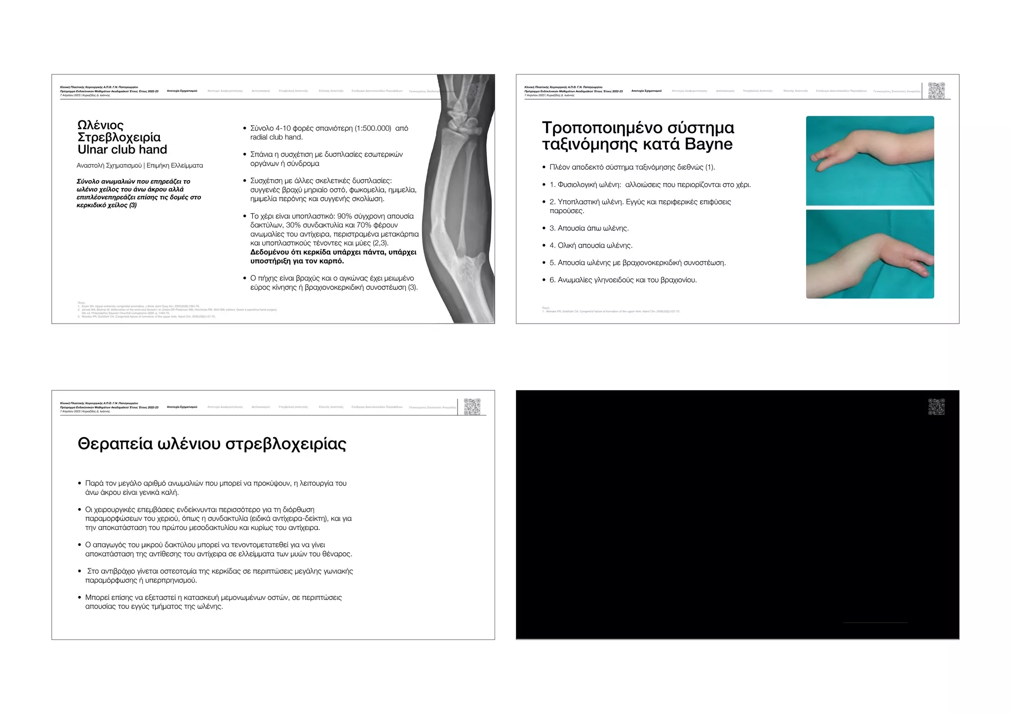 Congenital Hand Deformities Teaching.pdf